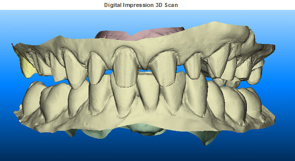 3D Scan